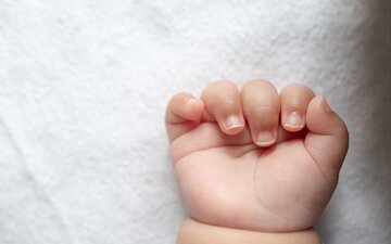  ۴۷ درصد مرگ ایرانی‌ها زودرس است وزیر بهداشت: در همه شاخص‌های سلامت بالاتر از منطقه هستیم/ گزارش جهانی: نوزادان در ایران زودتر از ۹ کشور منطقه می‌میرند