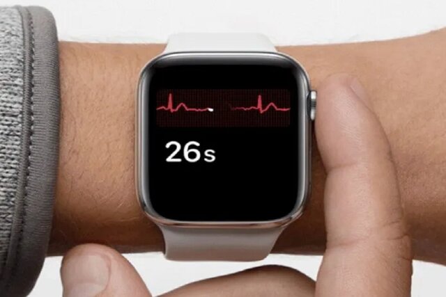تشخیص یک عارضه قلبی بی‌علامت با "اپل‌واچ"
