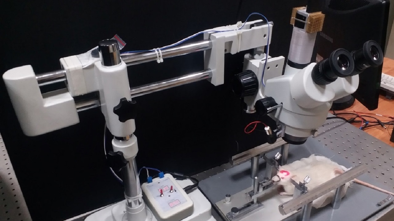 بومی سازی دستگاه تصویربرداری گرفتگی عروق در کشور