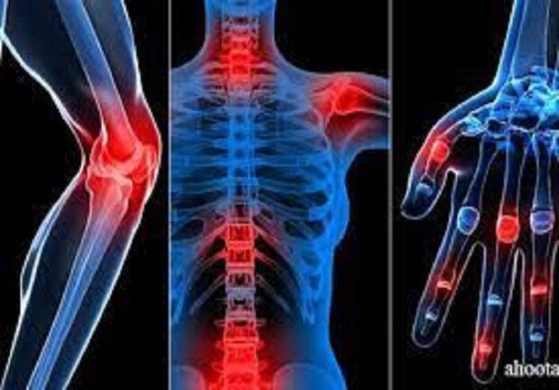 آرتروز بیماری فراگیر/راهکارهای کاهش آسیب و درمان چیست؟