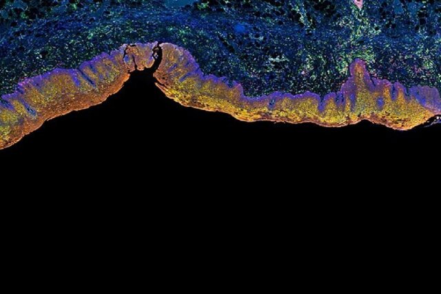 شناسایی مشخصه اصلی بیماری آلزایمر 