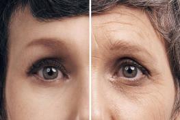  پیش‌بینی پیری بیولوژیکی ممکن می‌شود