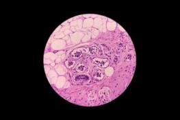 فناوری تلسکوپ چگونه متحول شده است؟