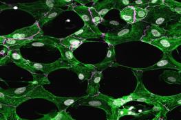 کشف اسرار سازمان‌دهی سلولی