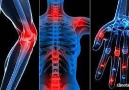 آرتروز بیماری فراگیر/راهکارهای کاهش آسیب و درمان چیست؟