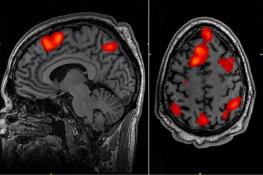سیل اطلاعات در ذهن افراد مسن، در هم ریختن خاطرات را به همراه دارد