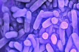 نابودی عفونت باکتریایی با ویروس!