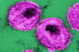  نانودامی که برای ویروس HIV پهن شد